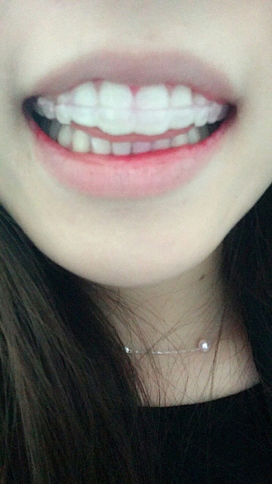 에이원치과 이미지