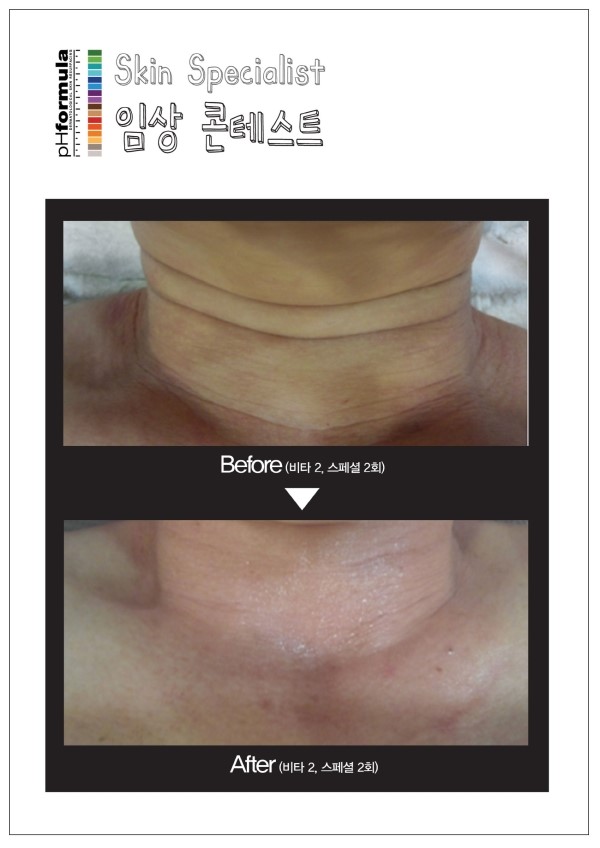 예인피부관리 이미지