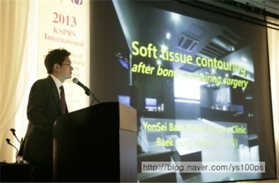 안면윤곽수술 후 연부조직 변화를 설명하는 풍선이론 자료