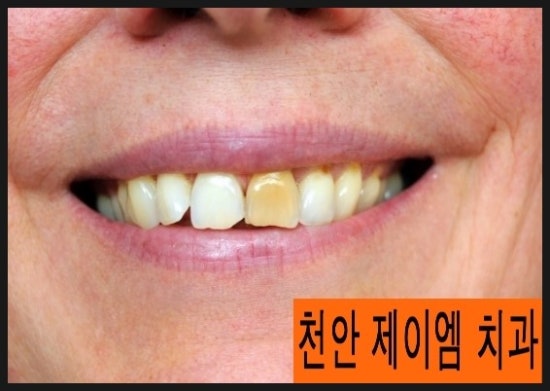 제이엠치과 이미지