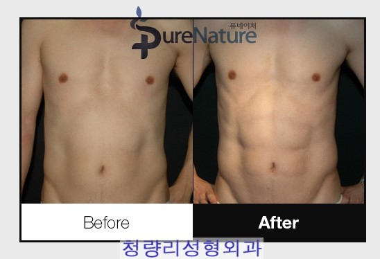 네이처성형외과 이미지