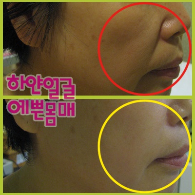 더예쁜피부관리실 이미지