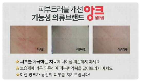 앙크 이미지