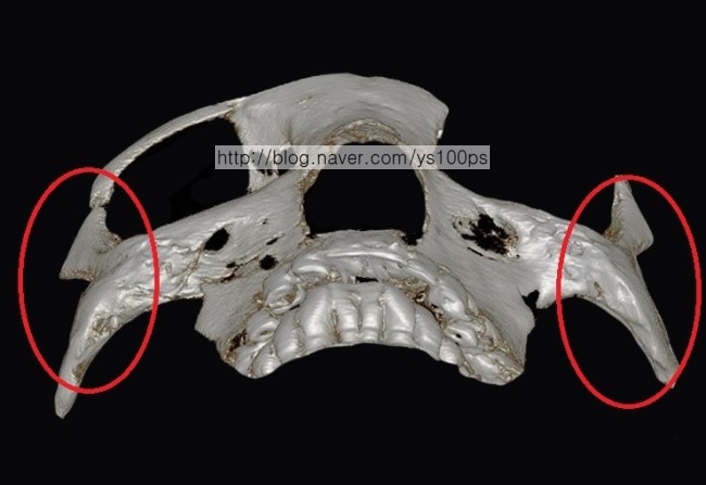 아래쪽에서 본 광대아치의 이동과 골 결손 3D CT
