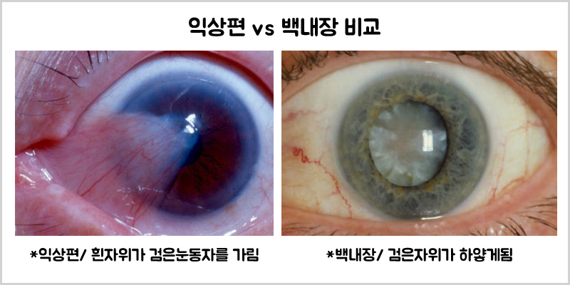 새봄안과 이미지