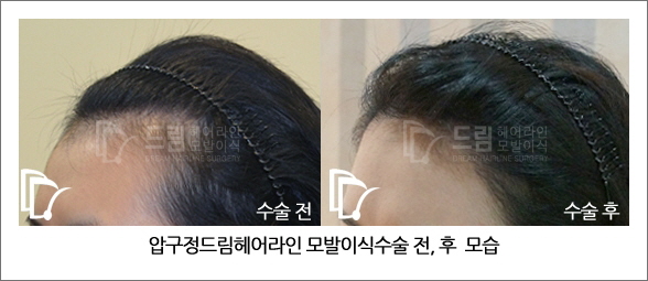 압구정M헤어 이미지