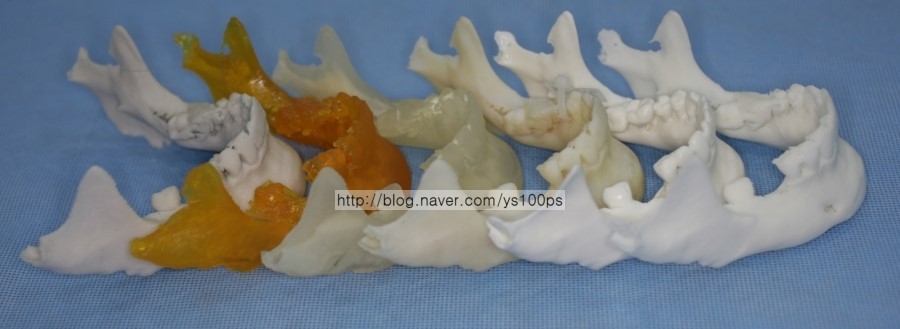 3D 프린팅 하악골 모형 6종의 측면 비교