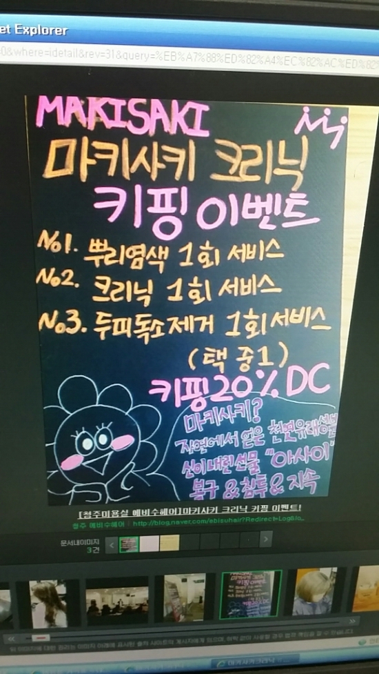 탑헤어라인 이미지