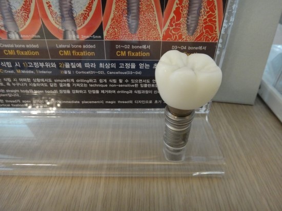 서울한치과 이미지