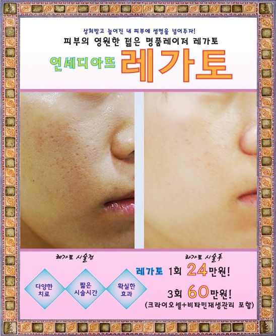 레가토 이미지