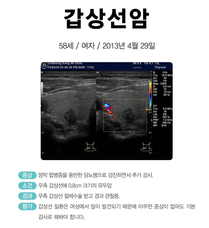 셀빙강내과의원 이미지
