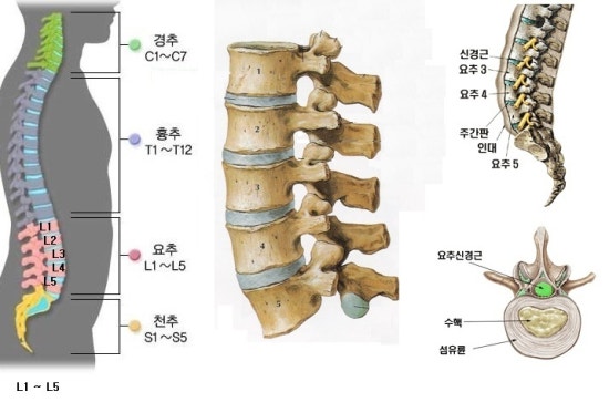 [요추]요추 CT데이터 3D프린터로 출력하기 : 네이버 블로그