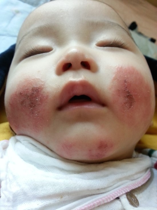 아토파인한의원 이미지