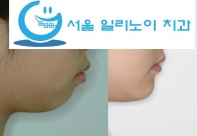 일리노이치과 이미지