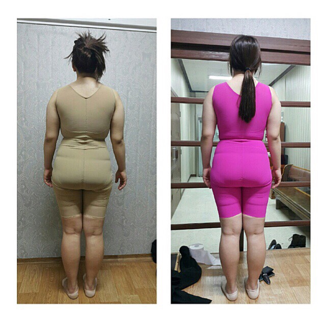 브리스건강기능성속옷 이미지