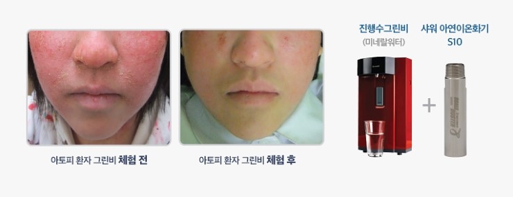 하이크린 이미지