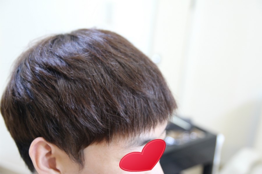 숱없는 남자머리로 인해 앞머리 갈라짐 (넓은이마 커버) 탈모헤어스타일 커버 전문샵 노원점 다비치레이디앤가이 : 네이버 블로그 숱없는 남자머리로 인해 앞머리 갈라짐 (넓은이마 커버) 탈모헤어스타일 커버 전문샵 노원점 다비치레이디앤가이 : 네이버 블로그