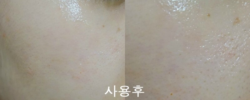 하이포엔터프라이즈 이미지