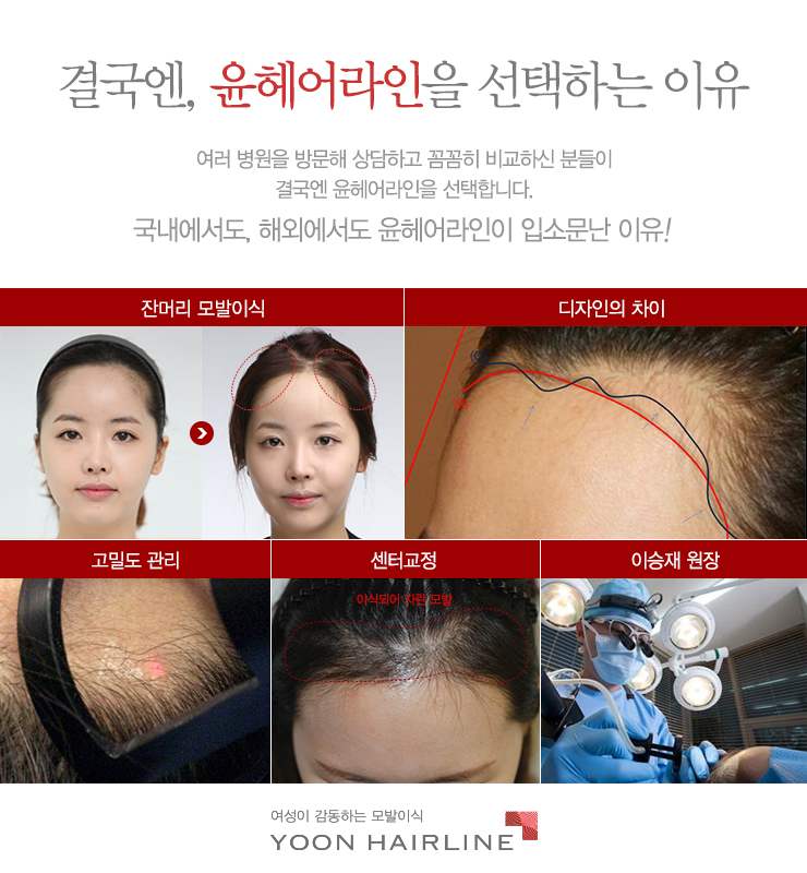 벨루스헤어 이미지