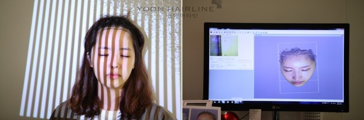 헤어라인 이미지