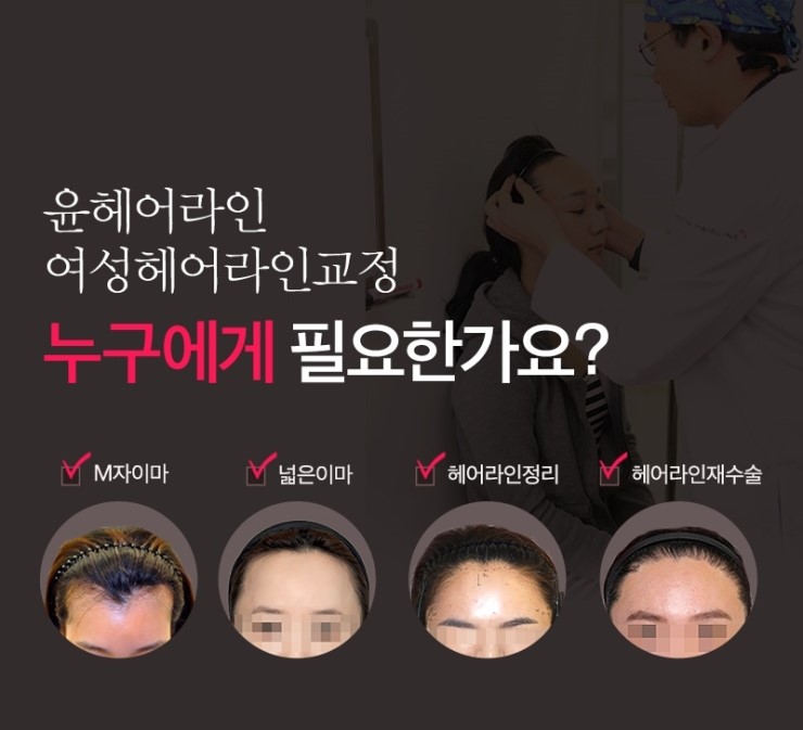 미헤어라인 이미지