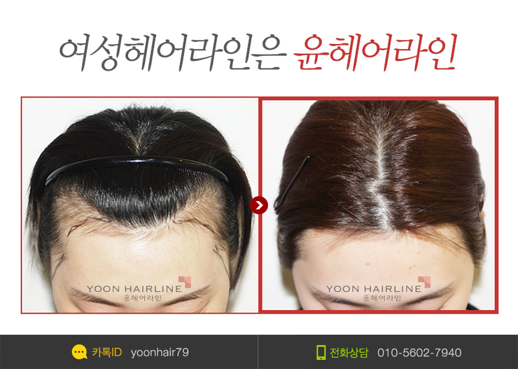 벨루스헤어 이미지