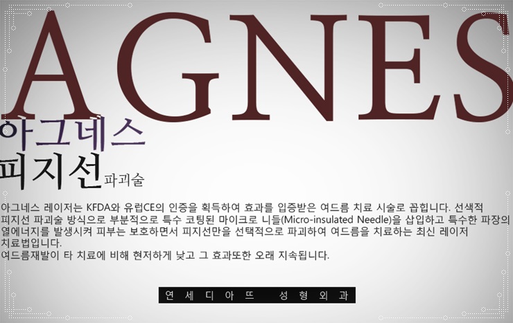아그네스 이미지