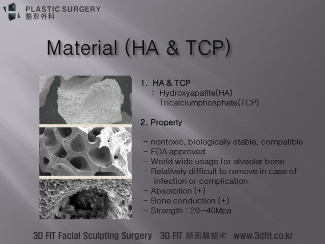 HA와 TCP 세라믹 골대체재