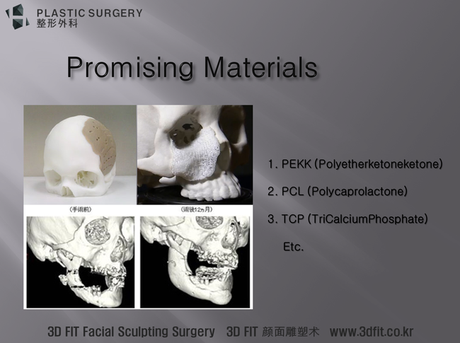 PEKK와 생분해성 3D 프린팅 재료