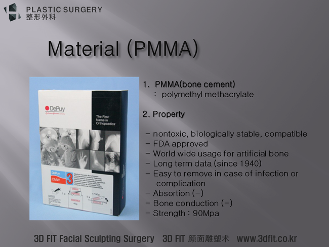 PMMA 본시멘트 보형물 재료