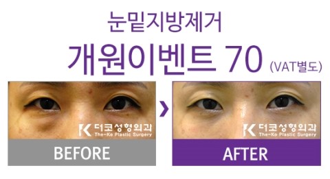 더코성형외과 이미지