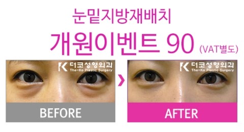 더코성형외과 이미지