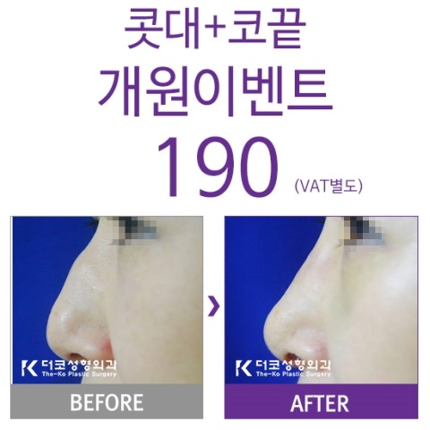 더코성형외과 이미지
