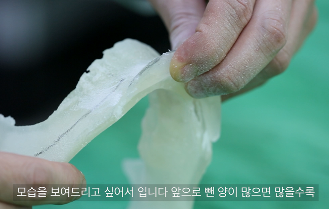 턱끝 전진량에 따라 커지는 이차각