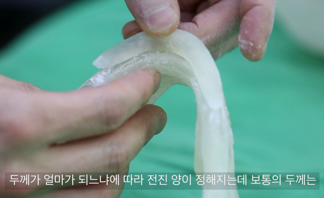 턱끝 골편과 남은 뼈의 접촉면