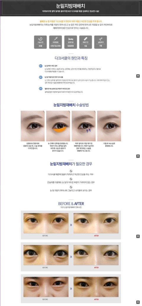 더코성형외과 이미지