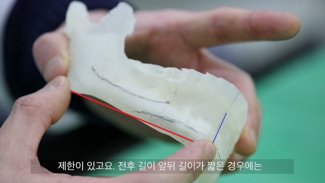턱끝의 앞뒤 길이와 상하 길이 표시