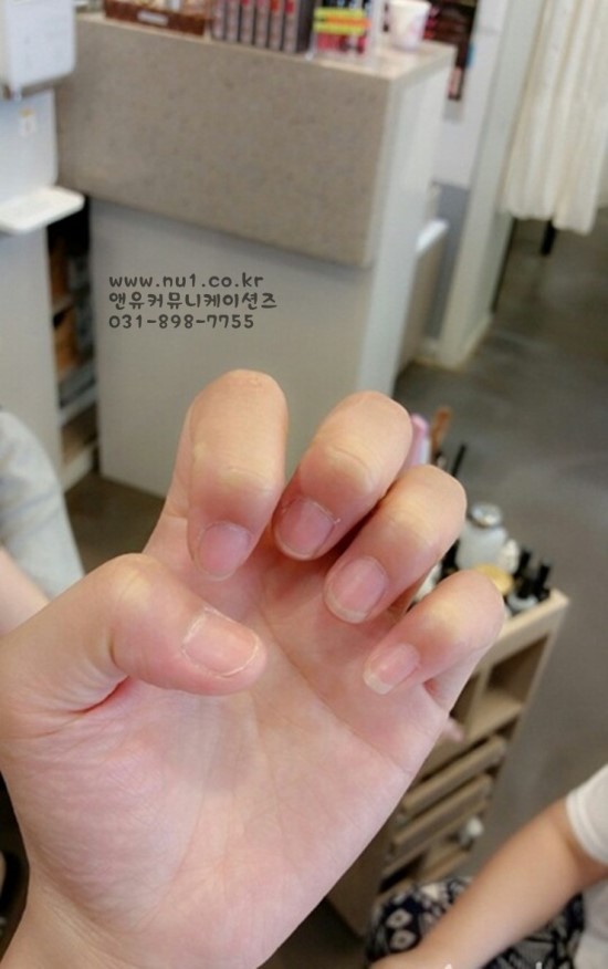 앵두손톱 이미지