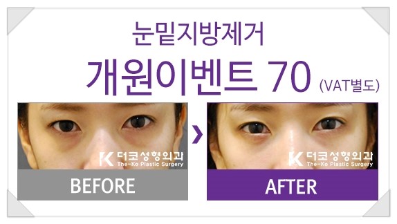 더코성형외과 이미지