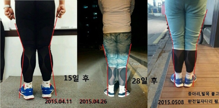 브리스건강기능성속옷 이미지