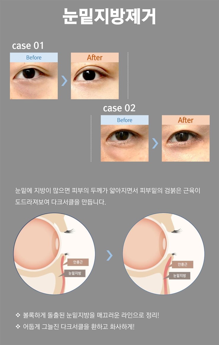 더코성형외과 이미지