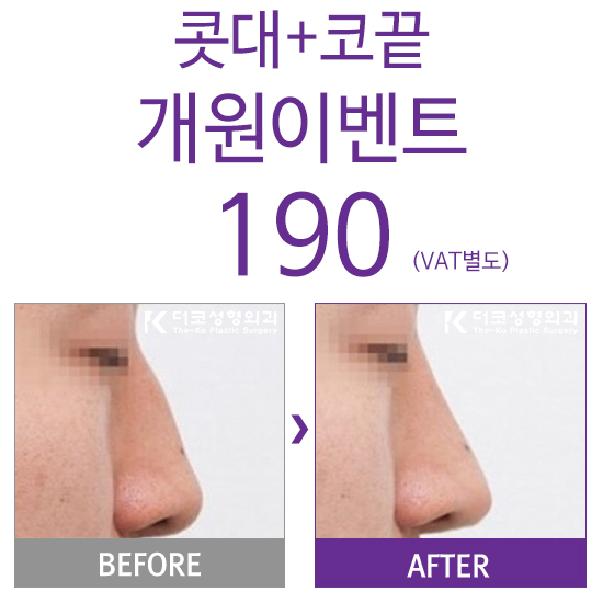 더코성형외과 이미지