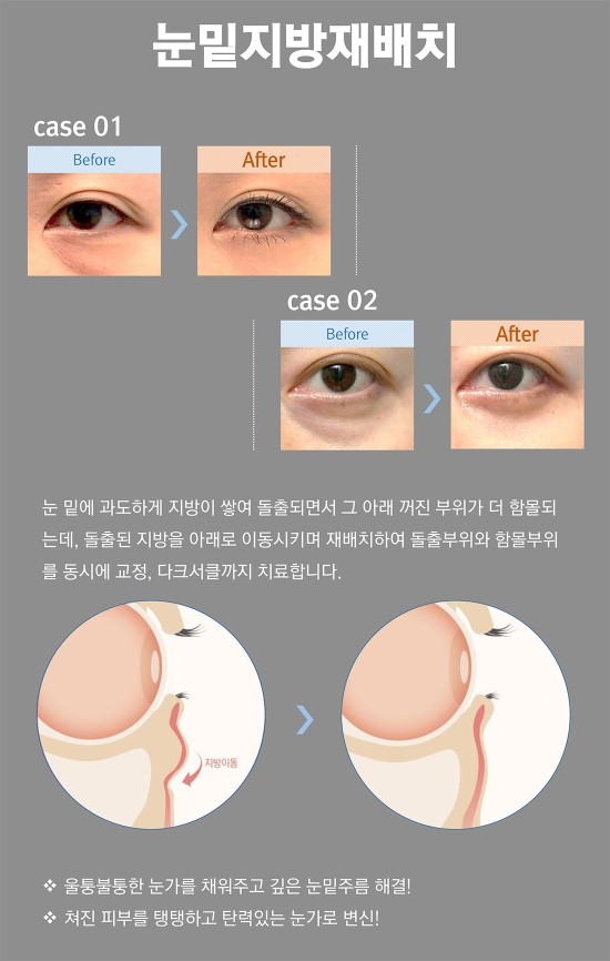 더코성형외과 이미지