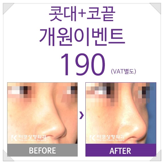 더코성형외과 이미지
