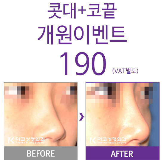 더코성형외과 이미지