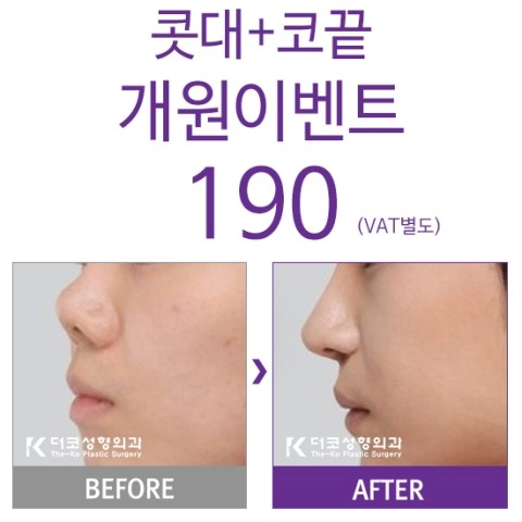 더코성형외과 이미지