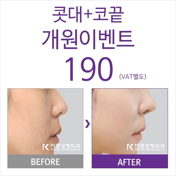 더코성형외과 이미지