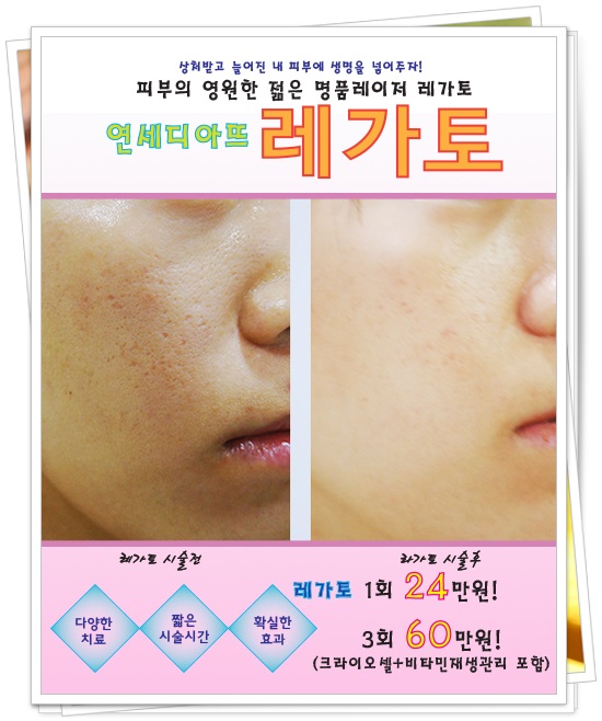 레가토 이미지