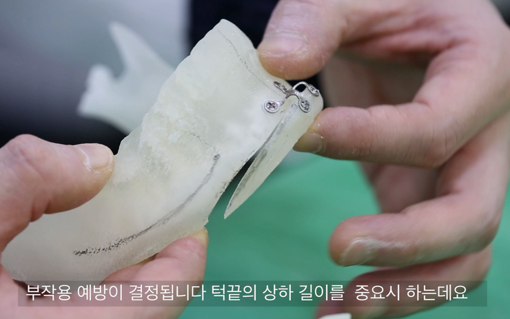 짧은 턱끝의 상하 길이 표시