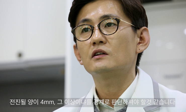 턱끝전진술 후 이차각이 생기는 3D 모델